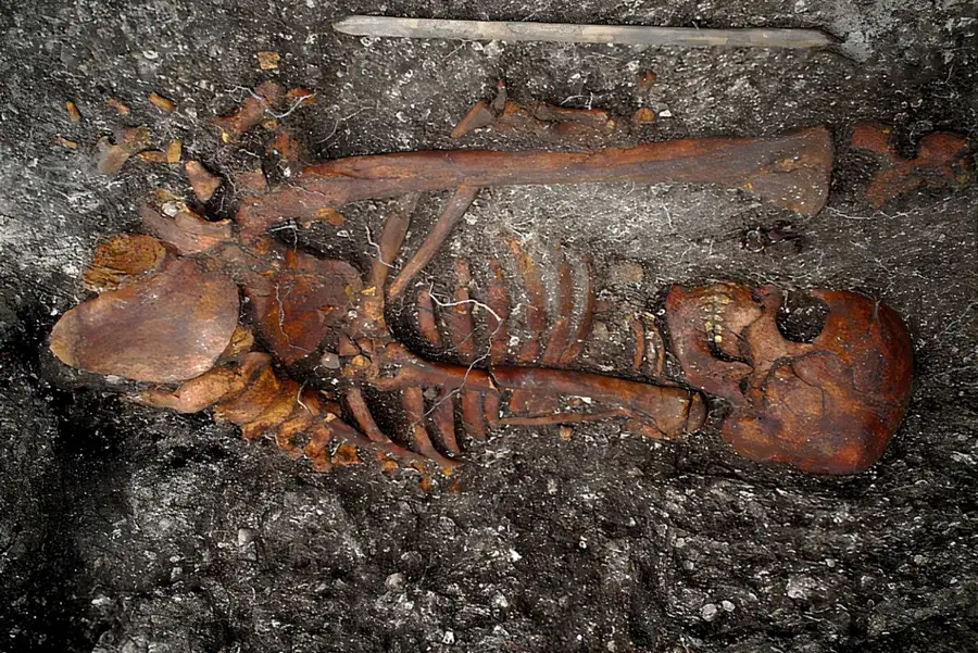 scheletro umano sepolto in preistoria nel sud del Brasile trovato DNA batteri simili alla sifilide